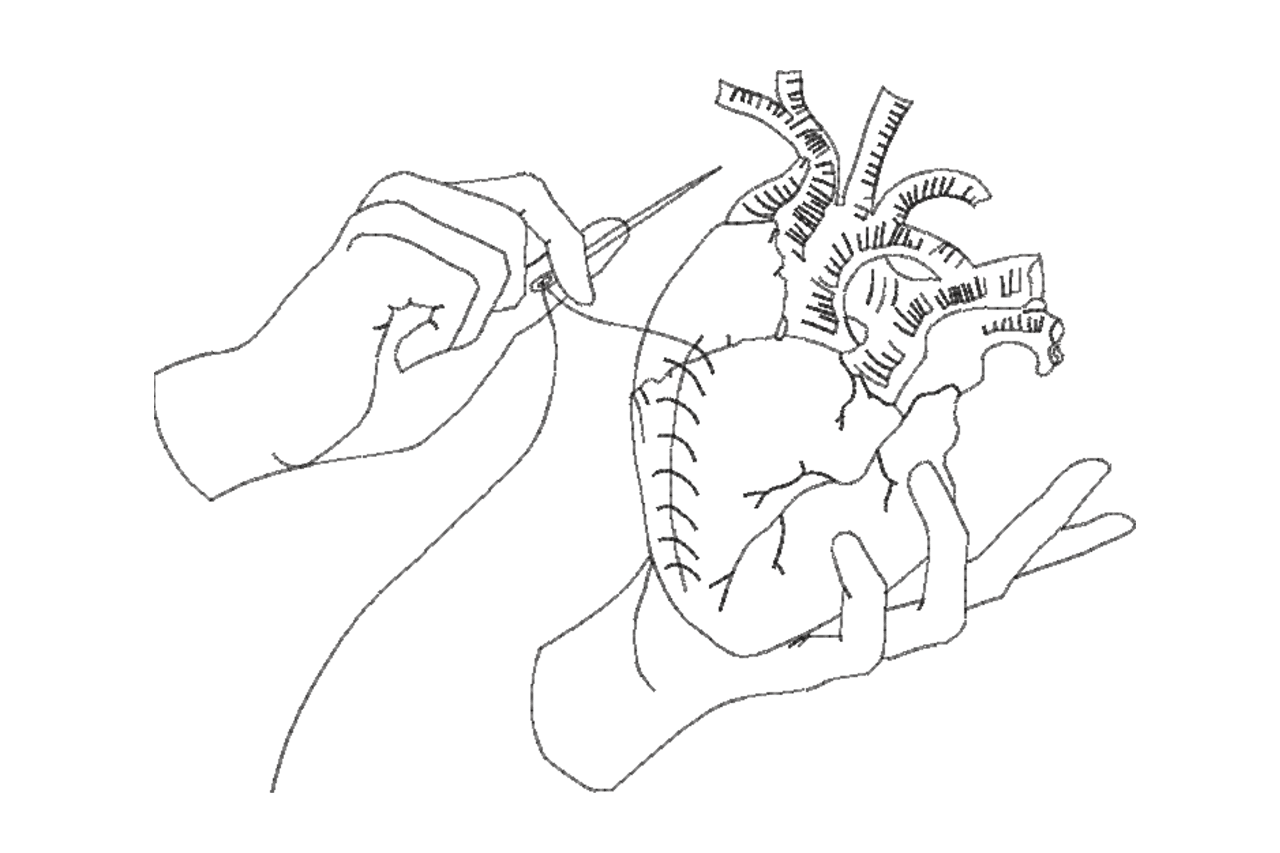 Anatomical Heart Sewing Machine Embroidery Design